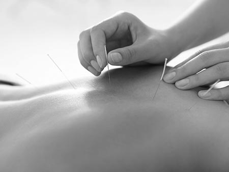 Acupuncture Marketing